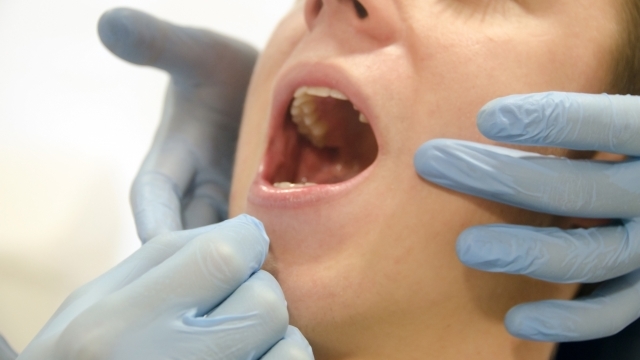 虫歯戦記② 虫歯治療で神経を抜く！その後の痛みは？